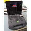 DW-C60 DAWEI Portable Laptop 4D Color Doppler Ultrasound System Machine Factory Price with CE ISO Approval